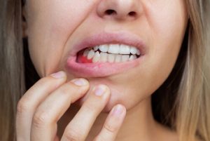 how to fix a gummy smile pain